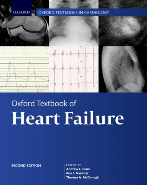 Oxford Textbook of Heart Failure Oxford Textbooks