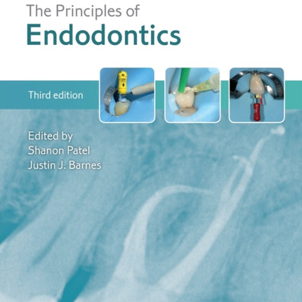 The Principles of Endodontics