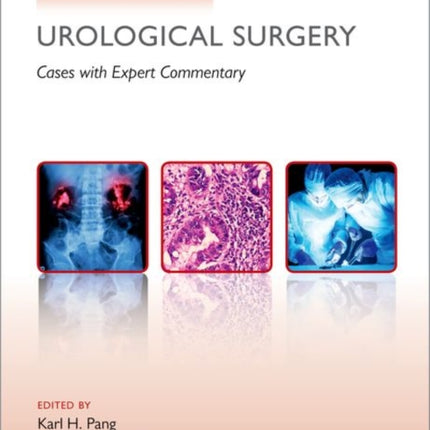 Challenging Cases in Urological Surgery Cases
