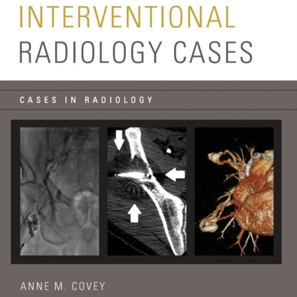 Interventional Radiology Cases
