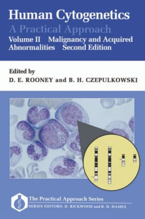 Human Cytogenetics A Practical Approach Volume II Malignancy and Acquired Abnormalities