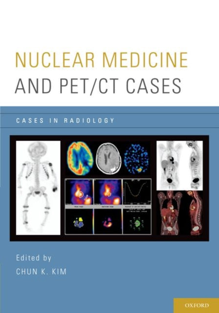 Nuclear Medicine and PETCT Cases