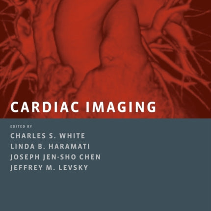 Cardiac Imaging