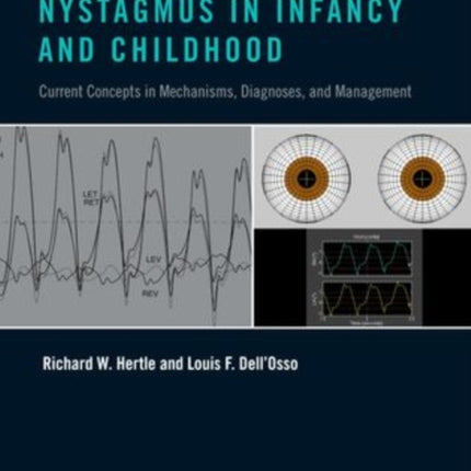 Nystagmus in Infancy and Childhood Current Concepts in Mechanisms Diagnoses and Management