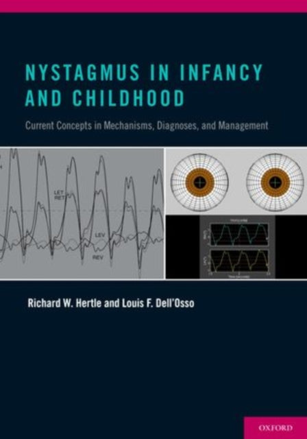 Nystagmus in Infancy and Childhood Current Concepts in Mechanisms Diagnoses and Management