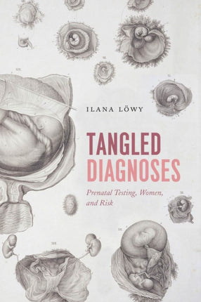 Tangled Diagnoses: Prenatal Testing, Women, and Risk