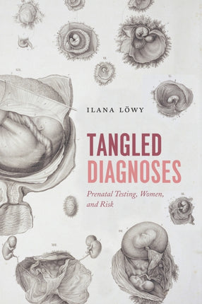 Tangled Diagnoses  Prenatal Testing Women and