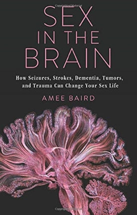 Sex in the Brain  How Seizures Strokes Dementia