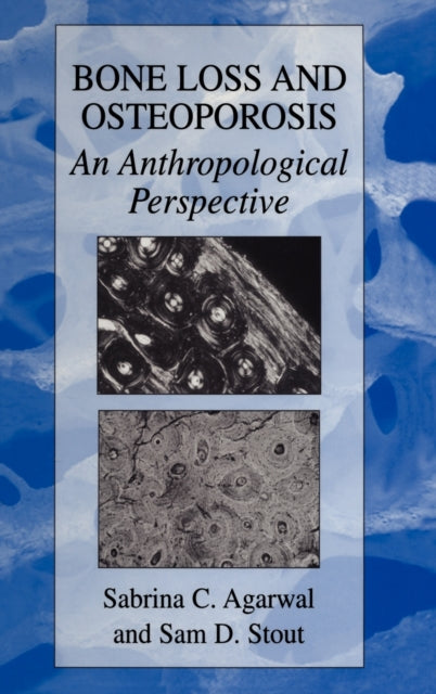 Bone Loss and Osteoporosis An Anthropological Perspective