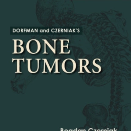 Dorfman and Czerniak's Bone Tumors