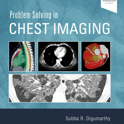 Problem Solving in Chest Imaging