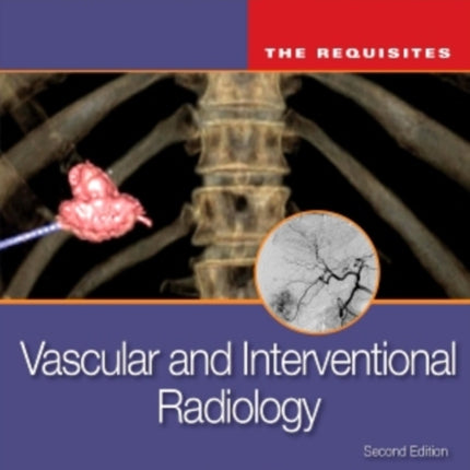 Vascular and Interventional Radiology: The Requisites