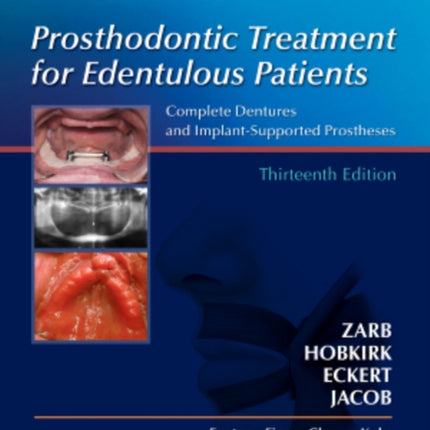 Prosthodontic Treatment for Edentulous Patients: Complete Dentures and Implant-Supported Prostheses