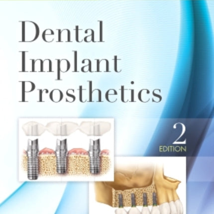 Dental Implant Prosthetics