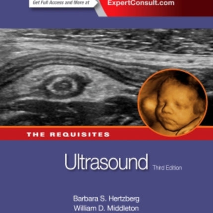 Ultrasound: The Requisites