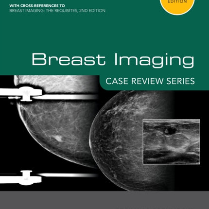 Breast Imaging: Case Review Series