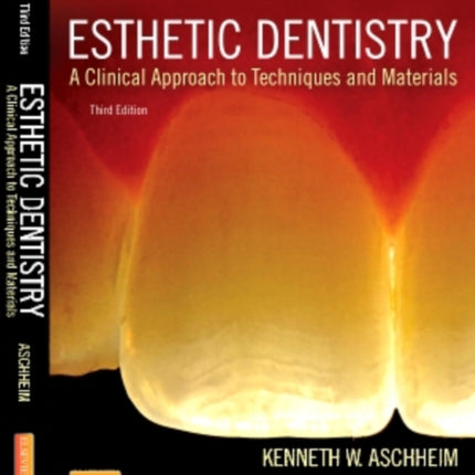 Esthetic Dentistry: A Clinical Approach to Techniques and Materials