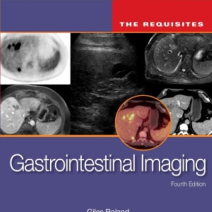 Gastrointestinal Imaging: The Requisites