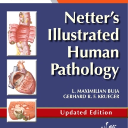 Netter's Illustrated Human Pathology Updated Edition: with Student Consult Access