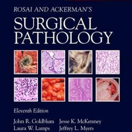 Rosai and Ackerman's Surgical Pathology - 2 Volume Set