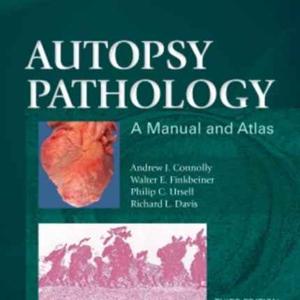 Autopsy Pathology: A Manual and Atlas