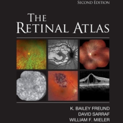 The Retinal Atlas