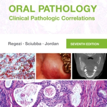 Oral Pathology: Clinical Pathologic Correlations