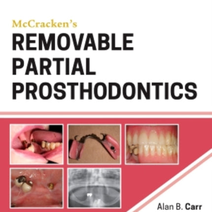 McCracken's Removable Partial Prosthodontics