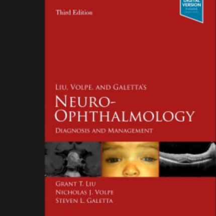 Liu, Volpe, and Galetta's Neuro-Ophthalmology: Diagnosis and Management