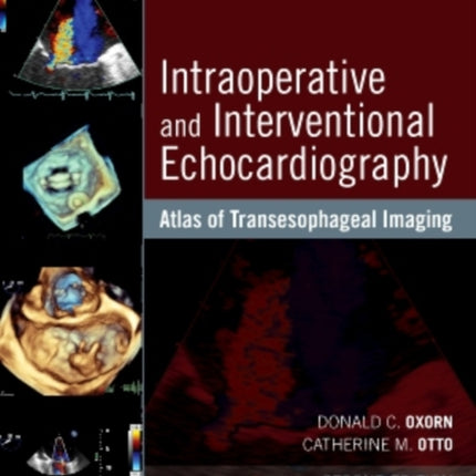 Intraoperative and Interventional Echocardiography: Atlas of Transesophageal Imaging