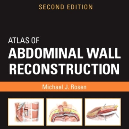 Atlas of Abdominal Wall Reconstruction