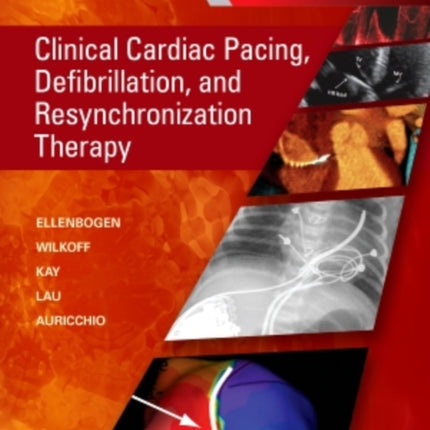 Clinical Cardiac Pacing, Defibrillation and Resynchronization Therapy