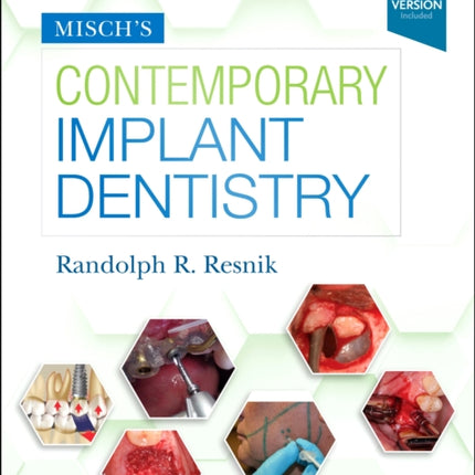 Misch's Contemporary Implant Dentistry