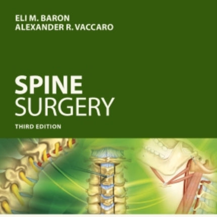 Operative Techniques: Spine Surgery