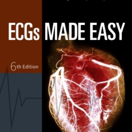 ECGs Made Easy