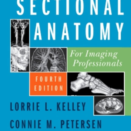 Sectional Anatomy for Imaging Professionals