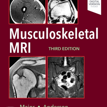 Musculoskeletal MRI