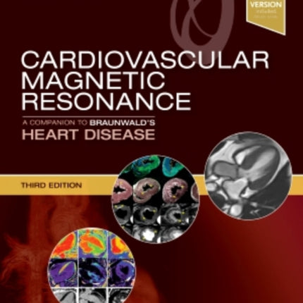 Cardiovascular Magnetic Resonance: A Companion to Braunwald's Heart Disease