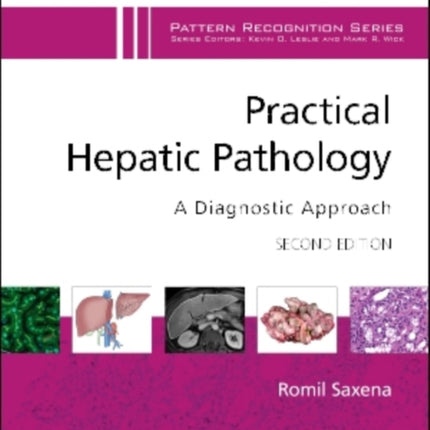 Practical Hepatic Pathology A Diagnostic Approach