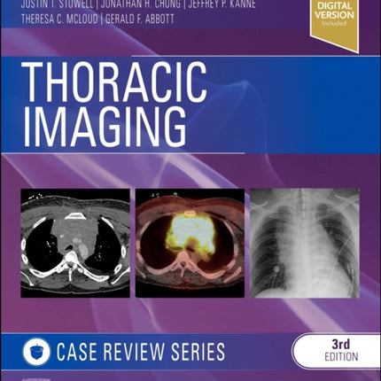 Thoracic Imaging: Case Review