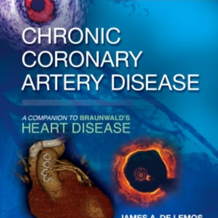 Chronic Coronary Artery Disease: A Companion to Braunwald's Heart Disease