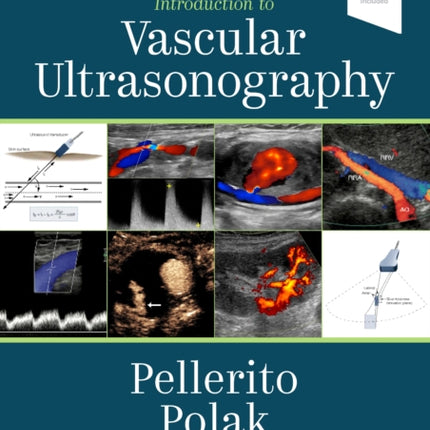 Introduction to Vascular Ultrasonography