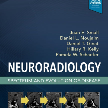 Neuroradiology: Spectrum and Evolution of Disease