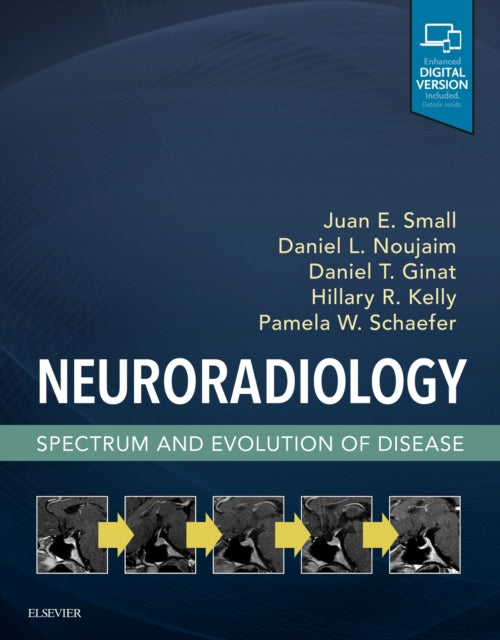 Neuroradiology: Spectrum and Evolution of Disease