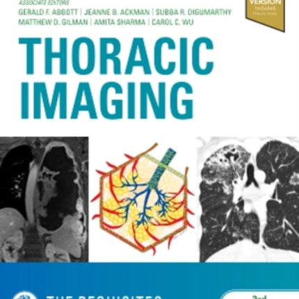 Thoracic Imaging The Requisites