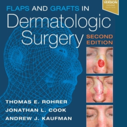 Flaps and Grafts in Dermatologic Surgery