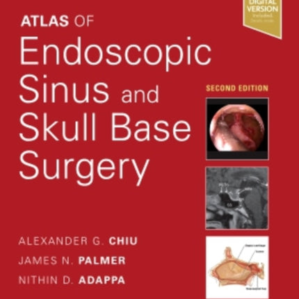 Atlas of Endoscopic Sinus and Skull Base Surgery