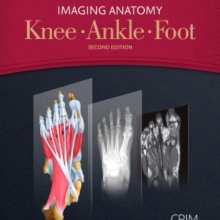 Imaging Anatomy: Knee, Ankle, Foot