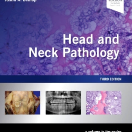 Head and Neck Pathology: A Volume in the Series: Foundations in Diagnostic Pathology