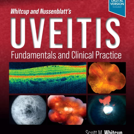 Whitcup and Nussenblatt's Uveitis: Fundamentals and Clinical Practice